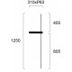 СТЕННА ЛАМПА SLIM LED 14W ЧЕРНА 3000K СТЕННА ЛАМПА SLIM LED 14W ЧЕРНА 3000K